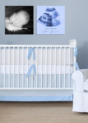 Custom Ultrasound Canvas