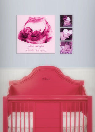 Custom Ultrasound Canvas