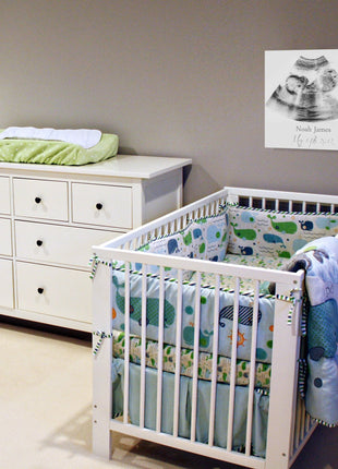 Custom Ultrasound Canvas