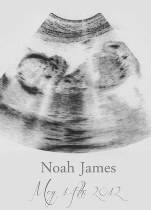 Custom Ultrasound Canvas